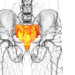 Kuyruk Sokumu Kırığı Ameliyatı (1)