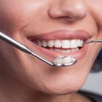 fethiye diş hekimi (6)