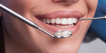 fethiye diş hekimi (6)