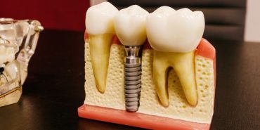 konya implant (3)
